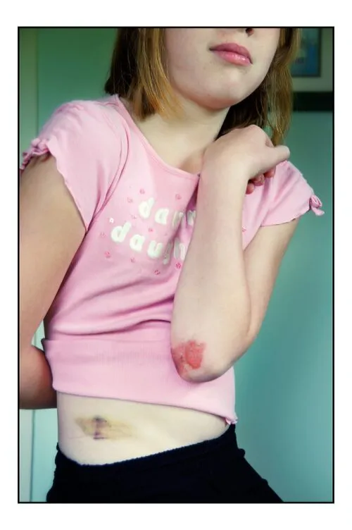 MukerjiLaw A LOOK BACK AT CHILD SAFETY IN 2014THE TRUE FACTS ABOUT COMMON CHILD DAYCARE INJURIES