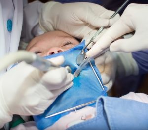 MukerjiLaw COMMON BOUNCE HOUSE INJURIES HEAD NECK LOSS OF TEETH AND MORE 300x265