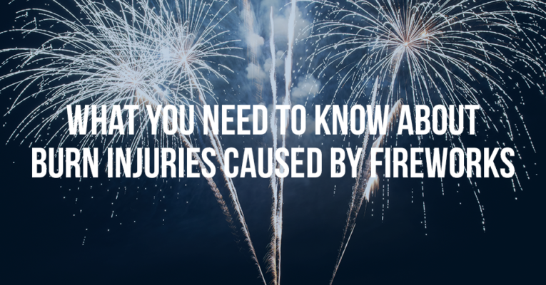 MukerjiLaw WHAT YOU NEED TO KNOW ABOUT BURN INJURIES CAUSED BY FIREWORKS 765x400